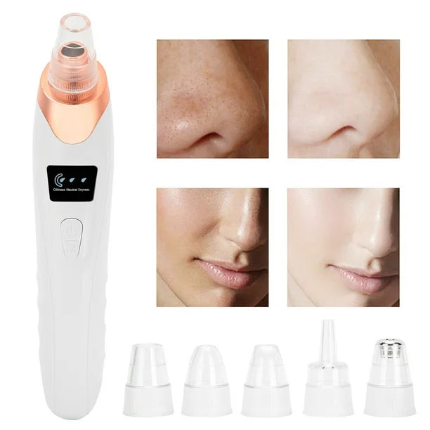 LumeFace® - Succionador facial de espinillas