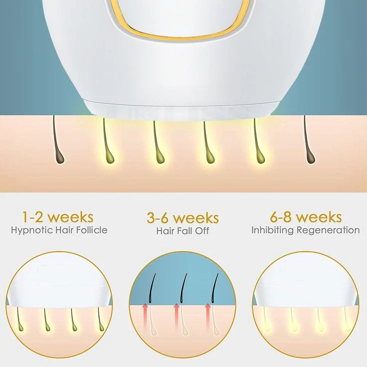 LumeSkin Pro - Depiladora IPL Premium