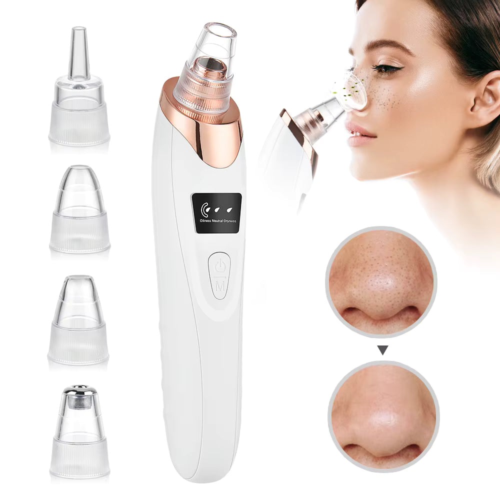 LumeFace® - Succionador facial de espinillas