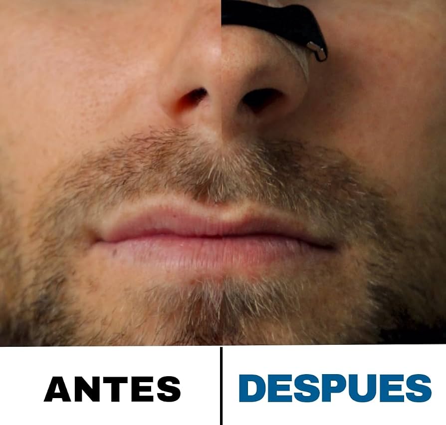 Dilatador Nasal Lume® – Tiras Nasales Magnéticas (4 niveles)