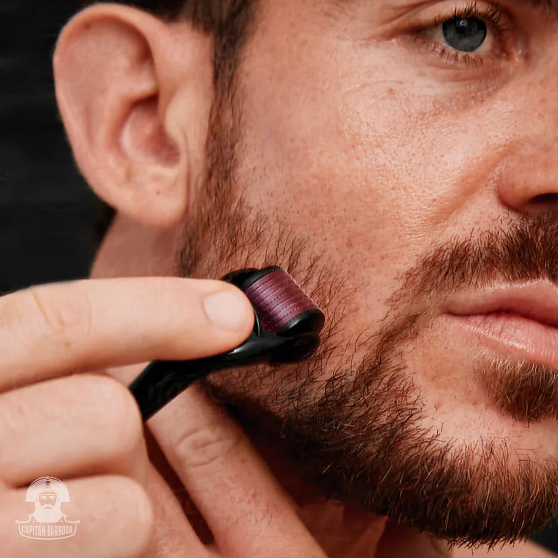 Minoxidil Kirkland® + Dermaroller de Regalo